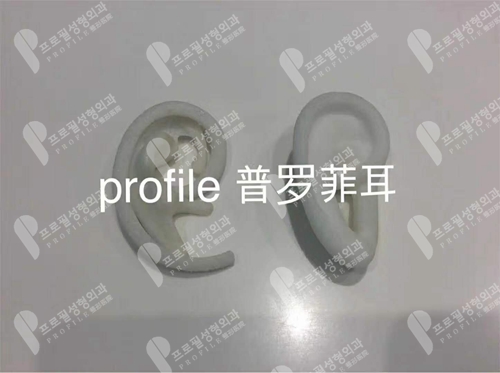 韩国profile普罗菲耳整形医院3d打印技术耳模