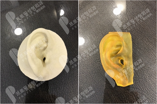 韩国profile普罗菲耳整形医院耳部模型