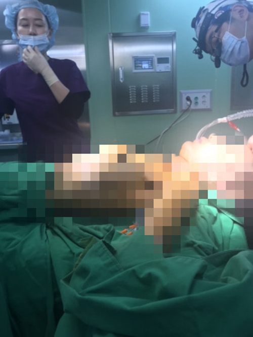 韩国profile普罗菲耳医院假体隆胸手术