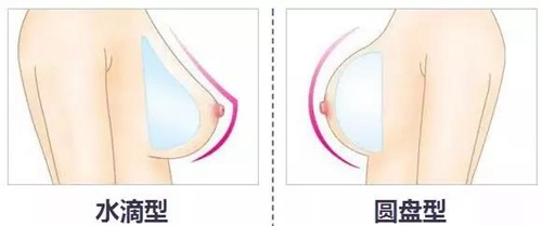 韩国profile普罗菲耳医院水滴型和圆盘形假体