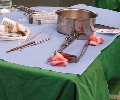 韩国profile普罗菲耳隆胸手术出血量