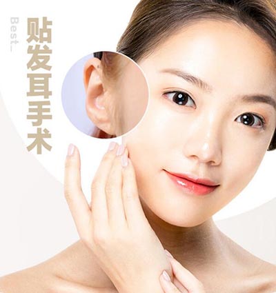 韩国profile普罗菲耳贴发耳手术