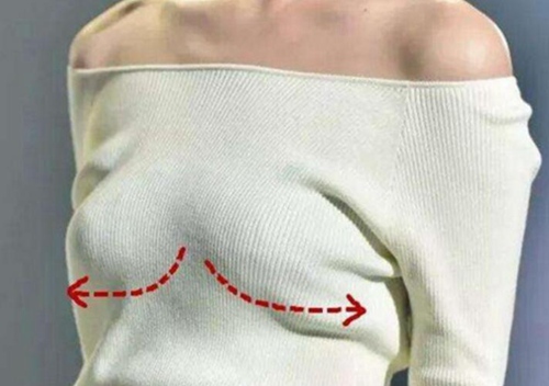 什么样的胸算下垂？乳房下垂松弛该如何矫正？