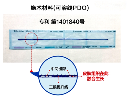 朴明旭院长小切口三重提升术施术材料