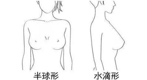 韩国profile普罗菲耳医院半球水滴形胸型