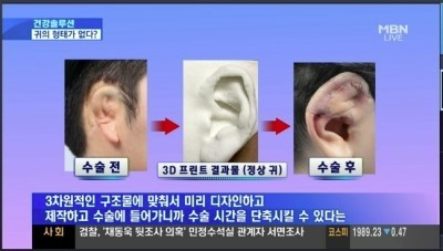 3d打印耳朵模型相关报道照片