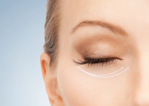 眼部除皱哪种手术效果更明显？