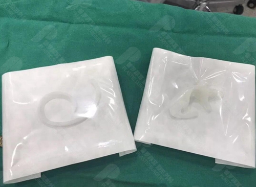 韩国普罗菲耳做耳再造手术使用的人工支架