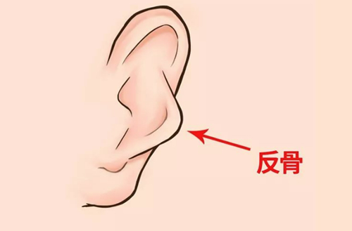 反骨耳朵是什么呢？