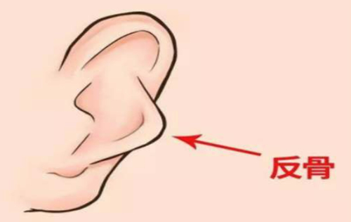 反骨耳能做手术矫正吗？